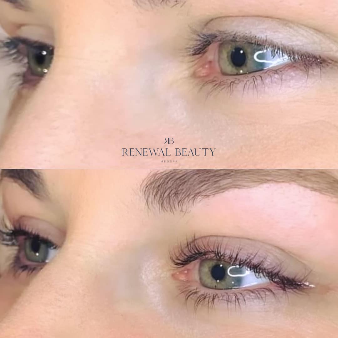 eyelash lift and tint before and after