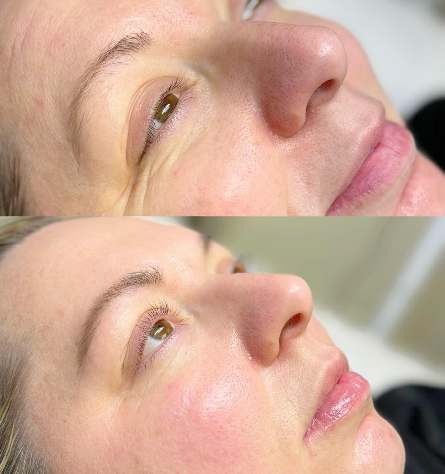 lash lift before and after